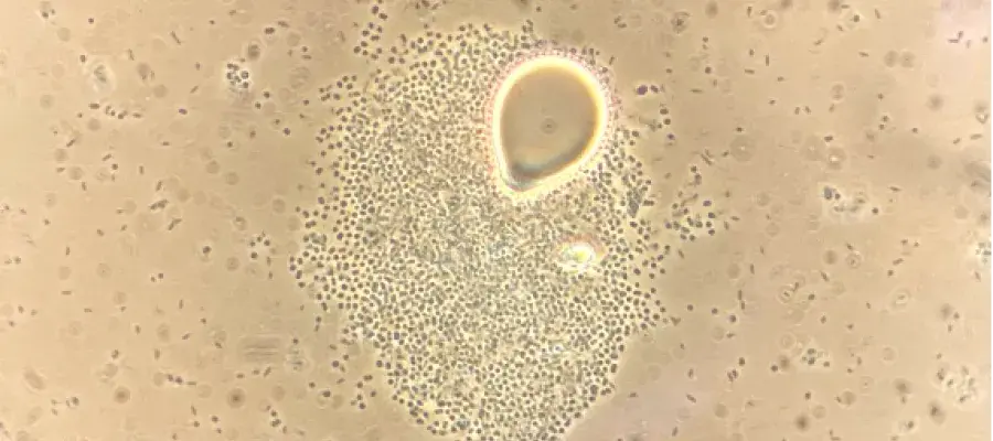 Droplet of diesel oil surrounded by hydrocarbon degrading bacteria