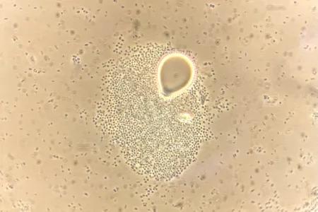 Droplet of diesel oil surrounded by hydrocarbon degrading bacteria