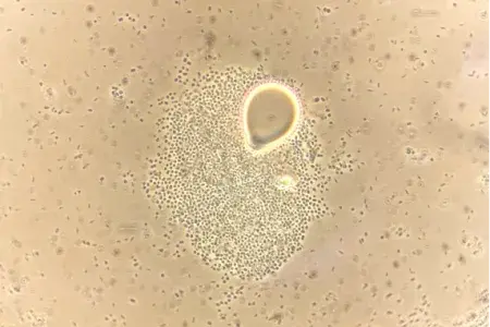Droplet of diesel oil surrounded by hydrocarbon degrading bacteria